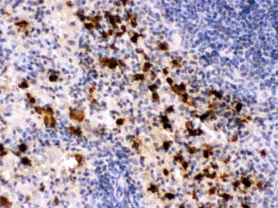 2 - Anti-S100A9 Picoband Antibody ABO12364
