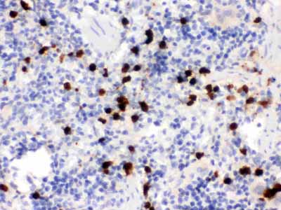 2 - Anti-S100A9 Picoband Antibody ABO12364