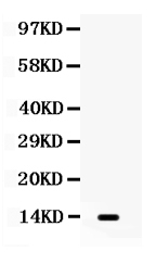 1 - Anti-S100A9 Picoband Antibody ABO12364