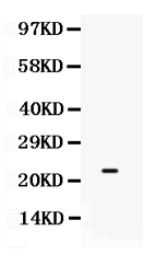 1 - Anti-SECTM1 Picoband Antibody ABO12365