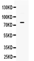 1 - Anti-GRK3 Picoband Antibody ABO12368