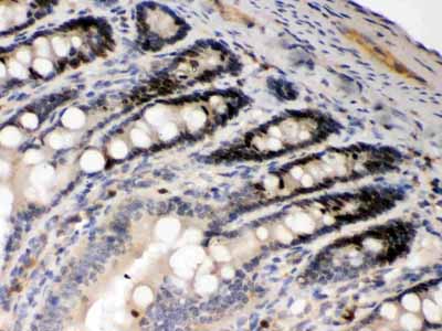 2 - Anti-AIM2 Picoband Antibody ABO12369