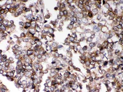 2 - Anti-AIM2 Picoband Antibody ABO12369