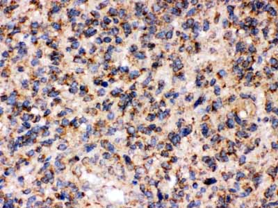 2 - Anti-FE65 Picoband Antibody ABO12370