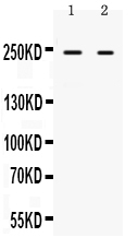 1 - Anti-ARID1A Picoband Antibody ABO12371