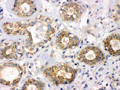 2 - Anti-B3GNT8 Picoband Antibody ABO12372