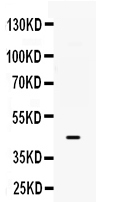1 - Anti-B3GNT8 Picoband Antibody ABO12372
