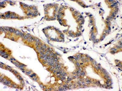 2 - Anti-BMP-2 Antibody ABO12373