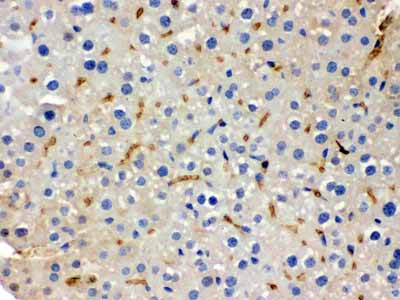 2 - Anti-BMP-5 Antibody ABO12375