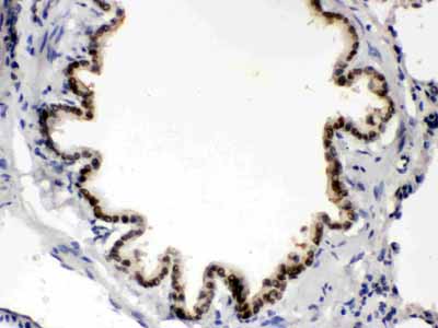 2 - Anti-BMP-5 Antibody ABO12375