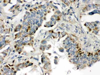 2 - Anti-BMP-5 Antibody ABO12375