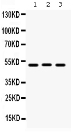 1 - Anti-BMP-5 Antibody ABO12375
