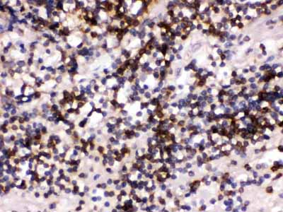 2 - Anti-CD22 Picoband Antibody ABO12377