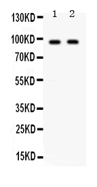 1 - Anti-CD22 Picoband Antibody ABO12377