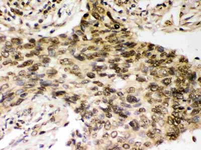 2 - Anti-Chk2 Picoband Antibody ABO12378