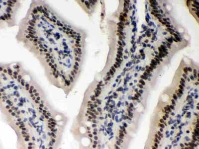 2 - Anti-CSNK1A1 Picoband Antibody ABO12379