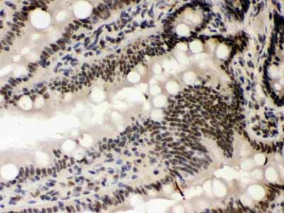 2 - Anti-CSNK1A1 Picoband Antibody ABO12379