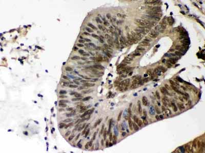 2 - Anti-CSNK1A1 Picoband Antibody ABO12379