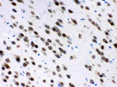 2 - Anti-ELAVL4 Picoband Antibody ABO12384