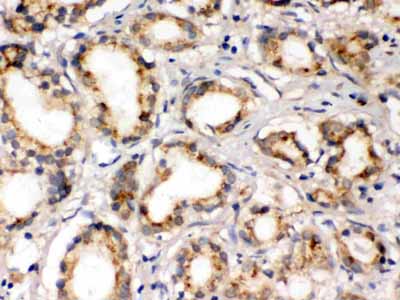 2 - Anti-FXYD1 Picoband Antibody ABO12390