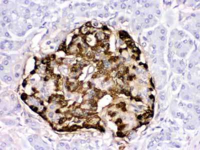 2 - Anti-GLP1 Picoband Antibody ABO12391