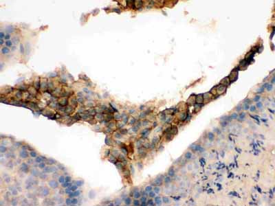 2 - Anti-GNAQ Picoband Antibody ABO12393