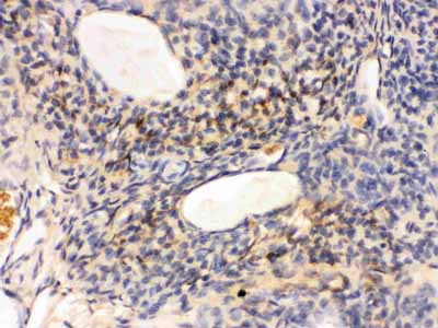 2 - Anti-GNAQ Picoband Antibody ABO12393