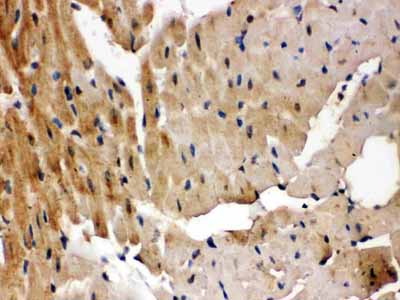 2 - Anti-GRK5 Picoband Antibody ABO12394