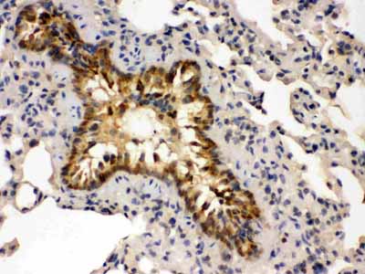 2 - Anti-GRK5 Picoband Antibody ABO12394