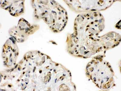 2 - Anti-GRK5 Picoband Antibody ABO12394