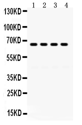 1 - Anti-GRK6 Picoband Antibody ABO12395