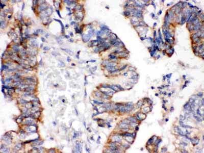 2 - Anti-IGFBP-3 Antibody ABO12396