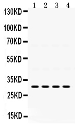 1 - Anti-IGFBP-3 Antibody ABO12396