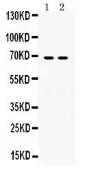 1 - Anti-Involucrin Picoband Antibody ABO12398
