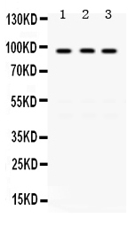 1 - Anti-KAT2A/GCN5 Picoband Antibody ABO12399