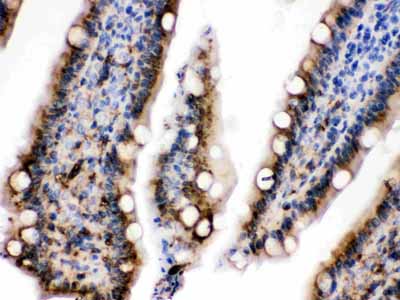 2 - Anti-Cytokeratin 19 Picoband Antibody ABO12401