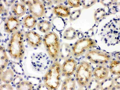 2 - Anti-Cytokeratin 19 Picoband Antibody ABO12401