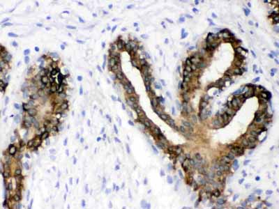 2 - Anti-Cytokeratin 19 Picoband Antibody ABO12401