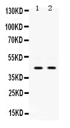 1 - Anti-Cytokeratin 19 Picoband Antibody ABO12401