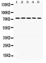 1 - Anti-LIMK1 Picoband Antibody ABO12402