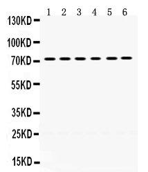 1 - Anti-LIM Kinase 2 Picoband Antibody ABO12403
