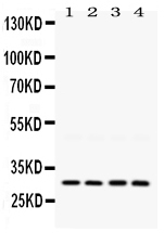 1 - Anti-LOX Picoband Antibody ABO12404