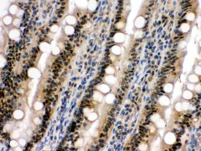 2 - Anti-SAPK4 Picoband Antibody ABO12407