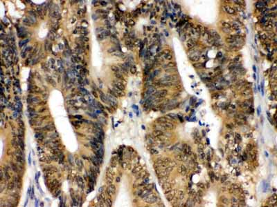 2 - Anti-SAPK4 Picoband Antibody ABO12407
