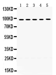 1 - Anti-MCM8 Picoband Antibody ABO12408