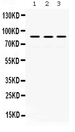 1 - Anti-MLH1 Picoband Antibody ABO12410