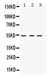 1 - Anti-MMP-1 Antibody ABO12411