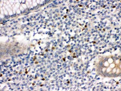 2 - Anti-MMP-8 Antibody ABO12412