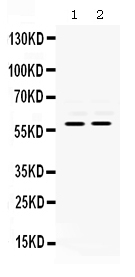 1 - Anti-MMP-8 Antibody ABO12412