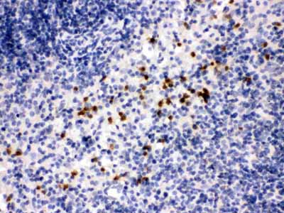2 - Anti-MMP-8 Antibody ABO12413
